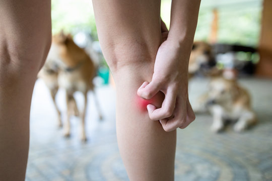 Concept of SFTS virus,close up,hand of asian child girl was scratching her legs,itching after touching,playing with the dogs,dangerous tick flea or insect bite,spread and infection from ticks in dogs