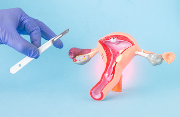 Doctor surgeon holds a surgical scalpel against the background of the layout of the female reproductive system. Concept of vaginal plastics, abortion, surgical operations 