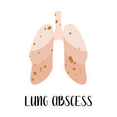 Lung abscess. Lungs disease. Pulmonology. Vector flat illustration. Perfect for flyer, medical brochure, banner, landing page, website