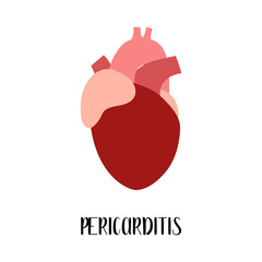 Pericarditis. Heart, cardiovascular diseases. Cardiology. Vector flat illustration. For flyer, medical brochure, banner, landing page, web