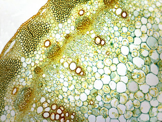 Microphotography of cross section of stem of carrot.