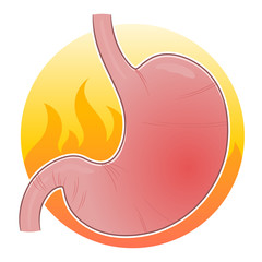 Stomach in fire illustration. Gastritis and stomach pain problem. 
