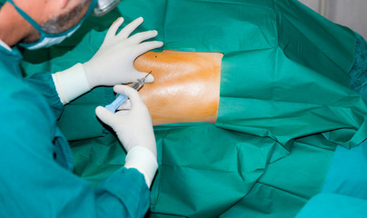 Anesthetic injection,Anesthesiologist or doctor prepping area where her is going to do a Epidural nerve or spinal block for a patient who is about to have a give birth per vaginal or cesarean section. - obrazy, fototapety, plakaty