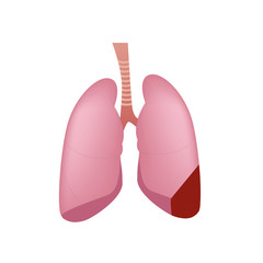 Human lungs, vector illustration, right lung inflammation