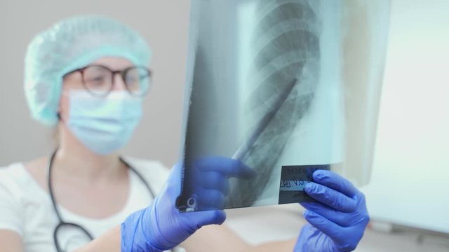 A young doctor doctor will erase a snapshot of the lungs. Diagnosis of pneumonia or tuberculosis. X-ray examination of the patient. Prevention, lung cancer, pneumonia and tuberculosis
