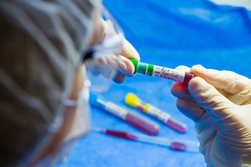 Hiv and aids infection test, doctors face and hand holding tube with blood on the blue background.