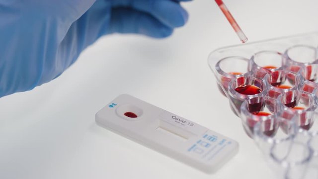 Close up shot of unrecognizable medical professional in gloves filling pipette with blood sample and putting droplet into diagnostic covid-19 kit