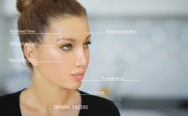 dermal filler treatments .Hyaluronic acid injections for specific areas.Correct wrinkles	 - obrazy, fototapety, plakaty