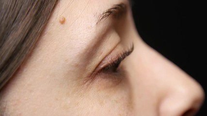 Woman smiles to reveal crows feet wrinkles.