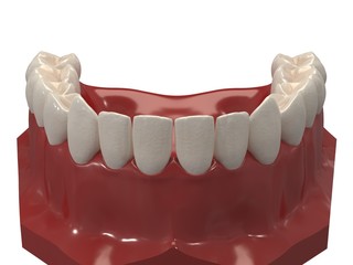 Removable orthodontic appliance is used after orthodontic treatment for retention. 3d render