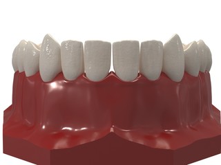 Removable orthodontic appliance is used after orthodontic treatment for retention. 3d render