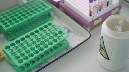coronavirus covid 19 is testing, researchers are finding ways to eliminate the corona virus...