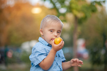 The daily life of a child with disabilities. A boy with Down syndrome eats a peach. Chromosomal and...