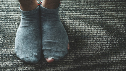 A pair of feet wearing old, dirty, and torn socks - obrazy, fototapety, plakaty