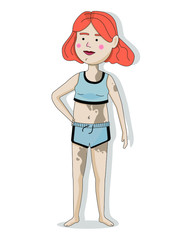 I love my body. Body positive movement. A person with imperfections. Skin pigmentation in a girl. Love for yourself and your body.