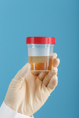 A container for biomaterial with a urine analysis in the hand of a doctor in a white rubber glove on a blue background.