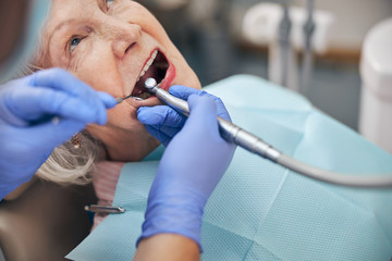 Dentist making the process of treating teeth beautiful senior Caucasian woman