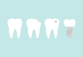 Teeth set line. Healthy white tooth, broken, ill with caries tartar and dental implant teeth.