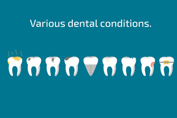 Various teeth conditions healthy, caries and dental implant.