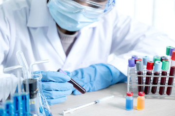 doctor's hand holding a sample blood tube for analysis and test virus disease in the laboratory,...