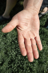 Calluses on the hands, Close-up of male hands