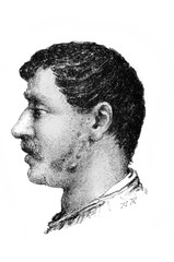 Disease on a man's cheek in the old book Diagnostik by Dr. Albert, Wien, 1900