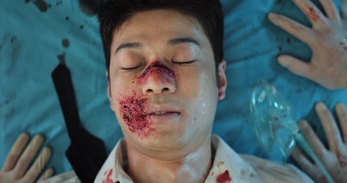 Young man with serious injuries mumbling while lying on hospital stretcher in ambulance. Close up view of asian guy with blood and wounds on his head paramedics transportating to clinic