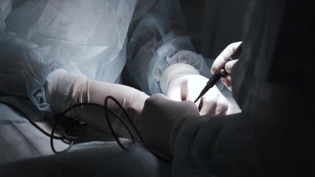 Surgeons performing operation under anesthesia. Action. Close-up surgeons open human tumor under anesthesia. Surgical treatment with correction of injuries and getting rid of diseases