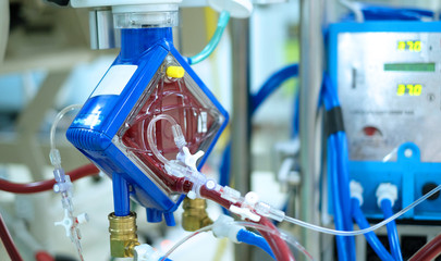 closeup oxygenator of ECMO (Extracorporeal membrane oxygenation) in critical care unit (CCU