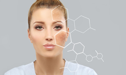 Dark spots, freckles,hyperpigmentation(melasma or chloasma),concept- skin lightening, skin...