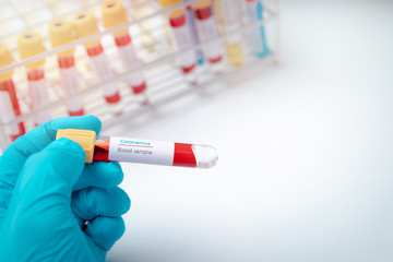 Fototapeta premium Researchers holding test tube with blood samples in the laboratory. Researchers are inventing vaccines to treat COVID-19 virus.
