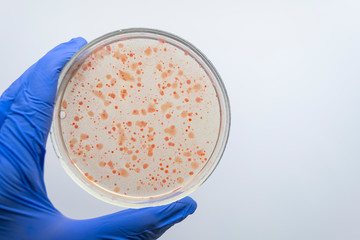 Close-up of a gloved scientist's hand holding a Petri dish with colonies of red bacteria.