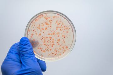 Scientists are studying the microbiota of the intestines and stomach of a person on a Petri dish, close-up.