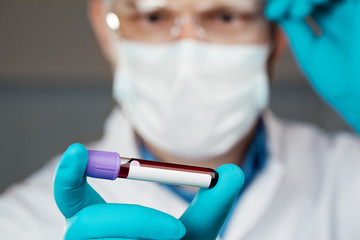 Coronavirus 2019-nCoV Blood Sample.