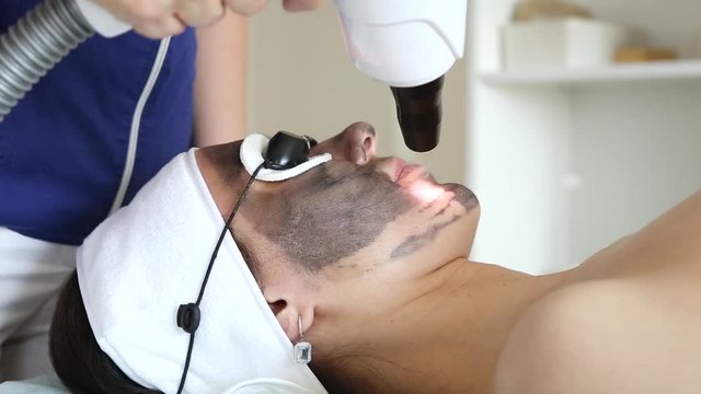 A cosmetologist is making carbon face peeling procedure in a beauty salon. Hardware cosmetology treatment. Video