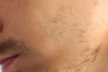 Fototapeta premium the problem of ungrown beard