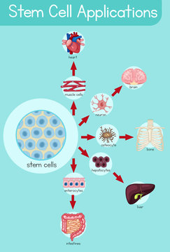 Informative Poster Of Stem Cell Applications