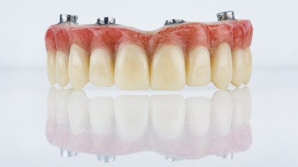 dental prosthesis for upper jaw with artificial gum on white background with creative reflection
