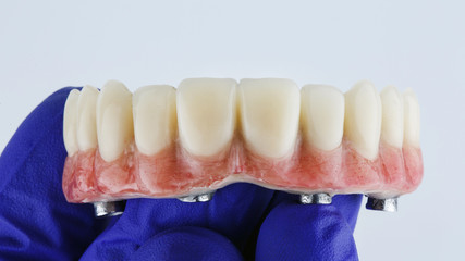 dental prosthesis of the upper jaw with artificial gum in the hand of the doctor on a white background