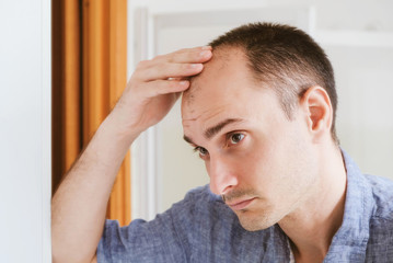 Young man looking at mirror worry about balding.