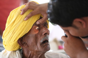 Old Indian man in Yellow turban from Rajasthan getting eyes tested. Eye camp. Eye patient. Weak eyesight. Eye Health. Eye examination by doctor. Healthcare to elderly. 