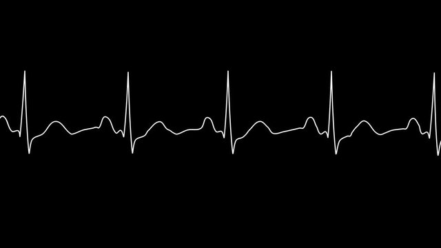 ECG looping.PNG Alpha.Normal Sinus Rhythm.Heart rate. Heart beat line template.Cardiogram monitor.Technological HUD for medicine and science,Medical Institute students.Type 1