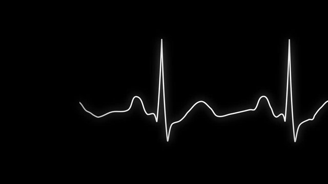 ECG looping.PNG Alpha.Normal Sinus Rhythm.Heart rate. Heart beat line template.Cardiogram monitor.Technological HUD for medicine and science,Medical Institute students.Type 3
