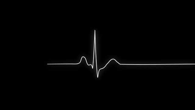 PNG Alpha.ECG looping.Normal Sinus Rhythm.Heart rate. Heart beat line template.Cardiogram monitor.Technological HUD for medicine and science,Medical Institute students.Type 4