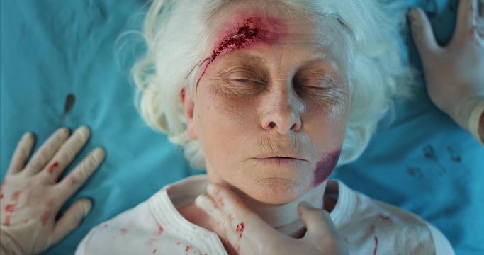 Close up of mature lady with blood and head wound riding with paramedics to hospital.Top view of injured old woman lying on medical transportation stretcher in ambulance