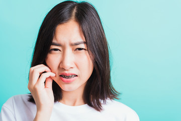Portrait of Asian teen beautiful young woman smile have dental braces on teeth laughing she unhappy pain toothache and touch cheek by hand, isolated on blue background, Medicine and dentistry concept