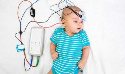 Newborn hearing screening and diagnosis at the hospital. Baby having hearing screening with special electrodes on his head and ear
