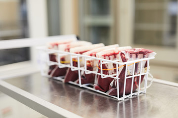 Image of donor blood in packages on the table in the laboratory