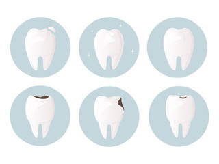 Set of teeth damaged by decay, cracks and chips. Tooth and enamel protection. Daily oral hygiene. Urgent medical dentistry is necessary for the restoration and treatment of teeth. vector flat design