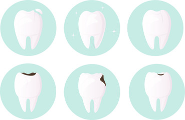 Set of teeth damaged by decay, cracks and chips. Tooth and enamel protection. Daily oral hygiene. Urgent medical dentistry is necessary for the restoration and treatment of teeth. vector flat design